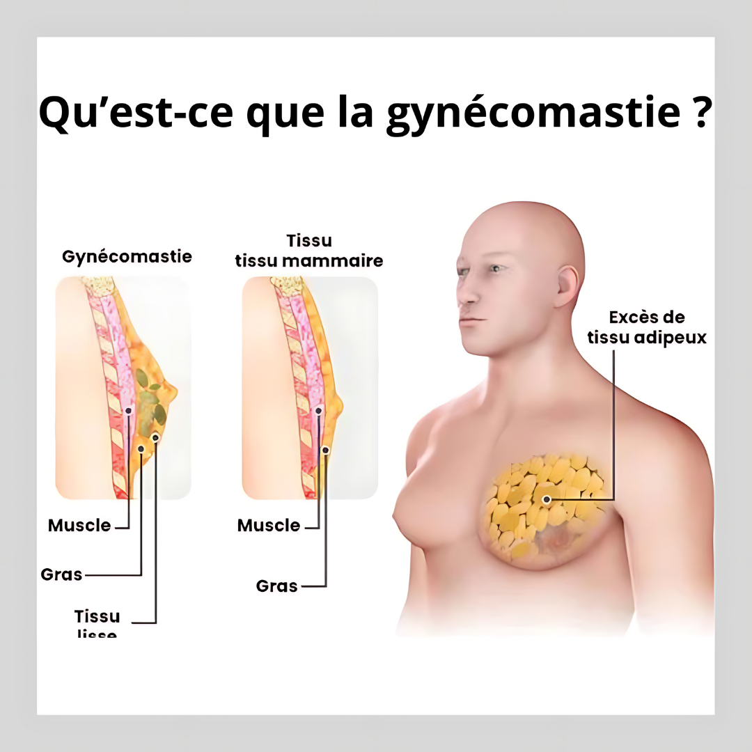 GILET AMINCISSANT | T-Boost®
